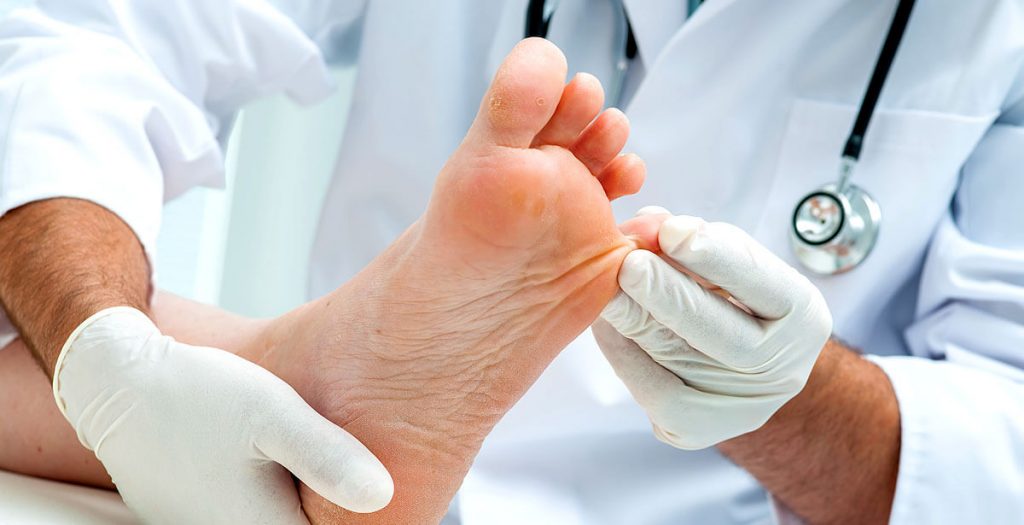 Pé da Atleta O que é - Podologia Braga